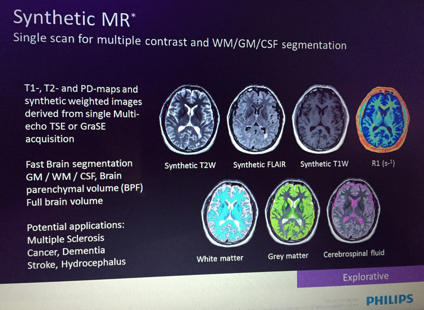 RSNA2014 その4 超 大衝撃 – GEのMAGiCとは？ | MRIfan.net