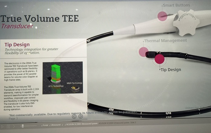 RSNA2014 その13 Siemens 〜経食道エコー realtime 4D | MRIfan.net