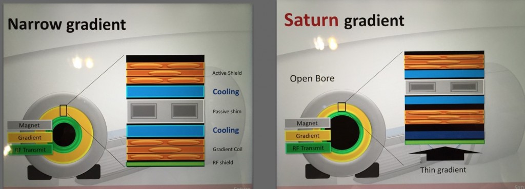 RSNA2014 その16 TOSHIBA MR 〜 Saturn Gradient搭載のTitan 3T MRI | MRIfan.net