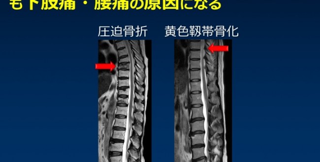 腰椎MRI検査の基本(撮像範囲や構造上注目すべき点) | MRIfan.net