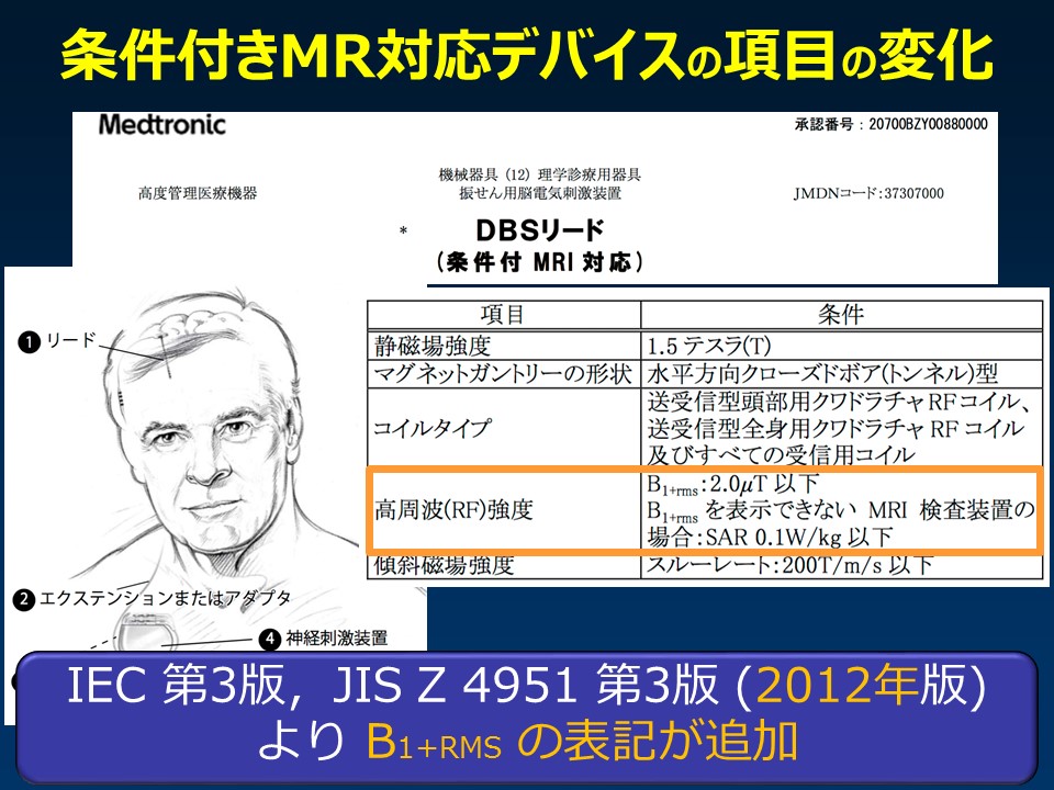 (B1+RMS)を徹底解説：東千葉メディカルセンター坂井上之 | MRIfan.net