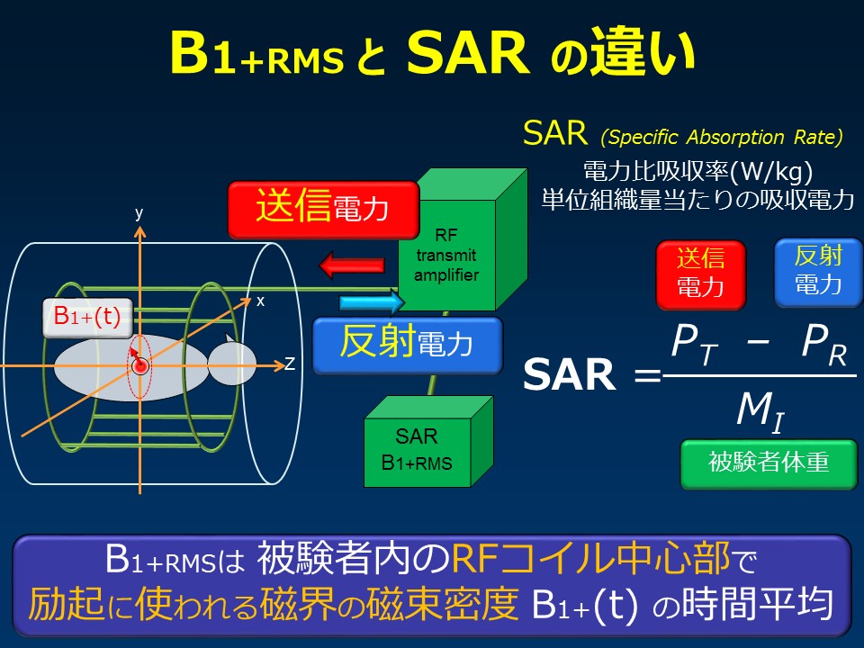 (B1+RMS)を徹底解説：東千葉メディカルセンター坂井上之 | MRIfan.net