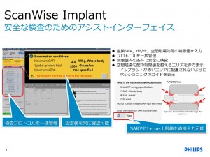 (B1+RMS)を徹底解説：東千葉メディカルセンター坂井上之 | MRIfan.net
