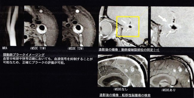 欲しいの ITEM2017 フィリップスヘルスケア ブースREPORT | MRIfan.net 絵画