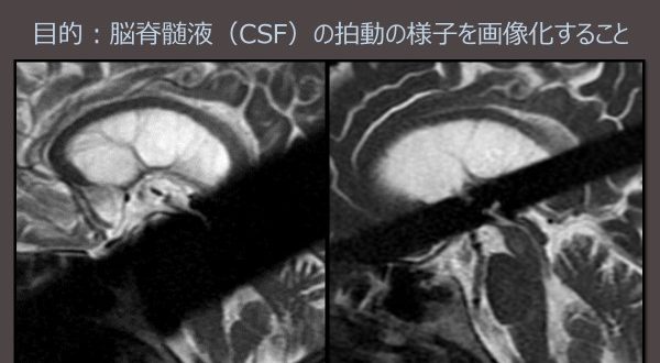 最後の院に選ばれる不定愁訴完全制覇テクニック　脳脊髄液循環の新発見 Amazon.co.jp: 最後の院に選ばれる 不定愁訴完全制覇テクニック