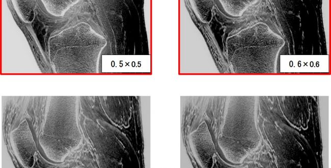 SIGNA甲子園2021 銅賞授賞演題「oSTEo Like Imaging のコツ」 | MRIfan.net SIGNA甲子園2021 銅賞授賞演題「oSTEo Like Imaging のコツ」 | MRIfan.net