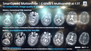 ITEM2023 ~Philips編~ | MRIfan.net