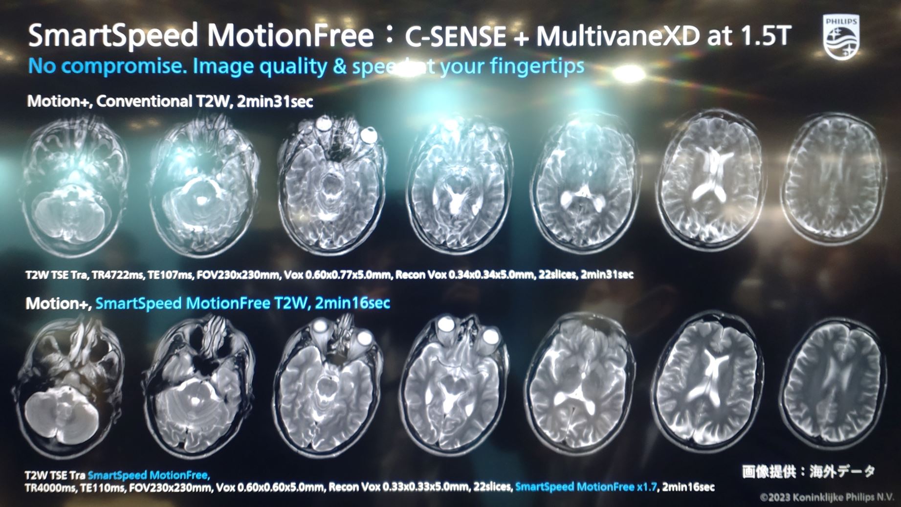 ITEM2023 ~Philips編~ | MRIfan.net