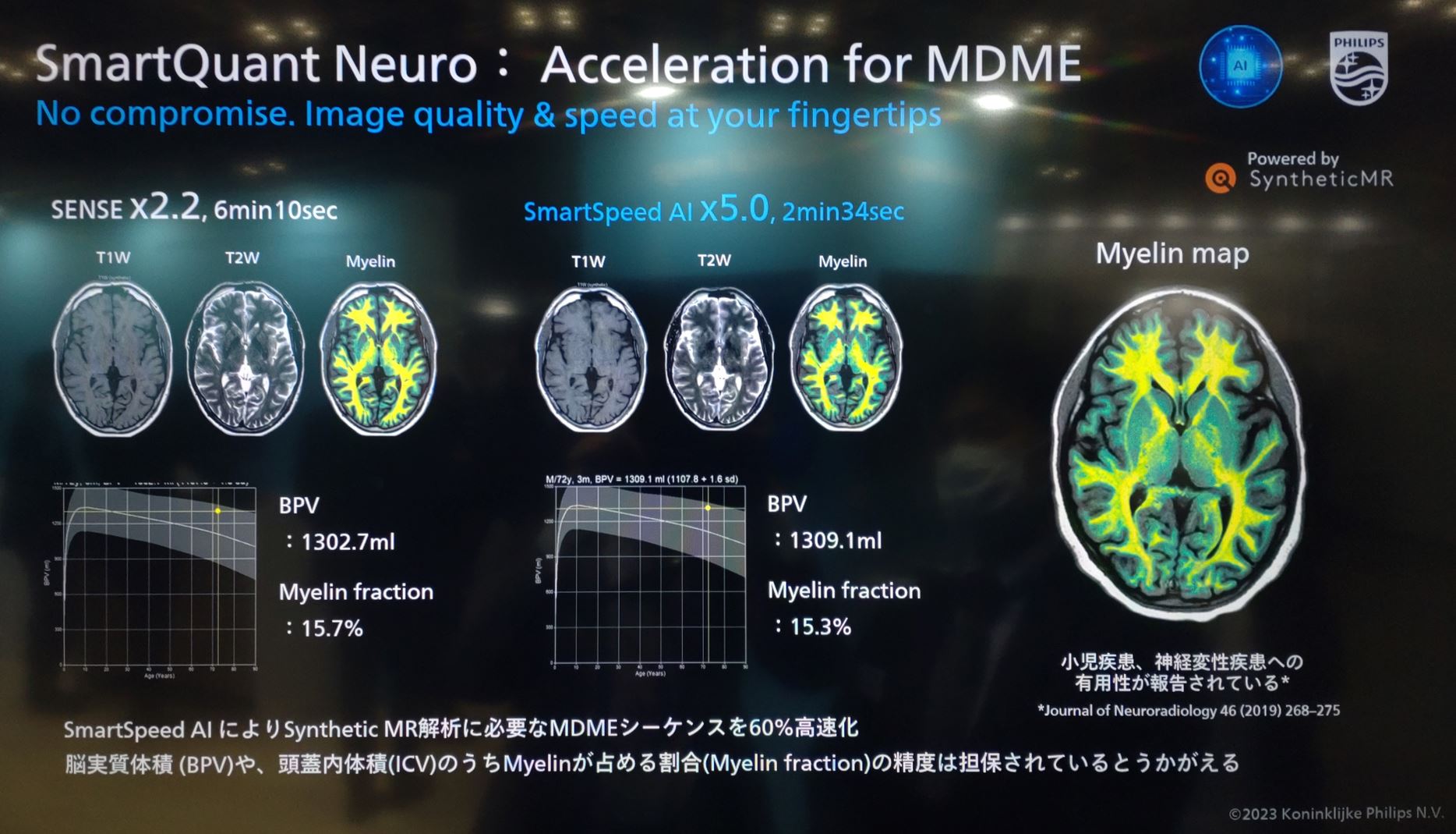 ITEM2023 ~Philips編~ | MRIfan.net