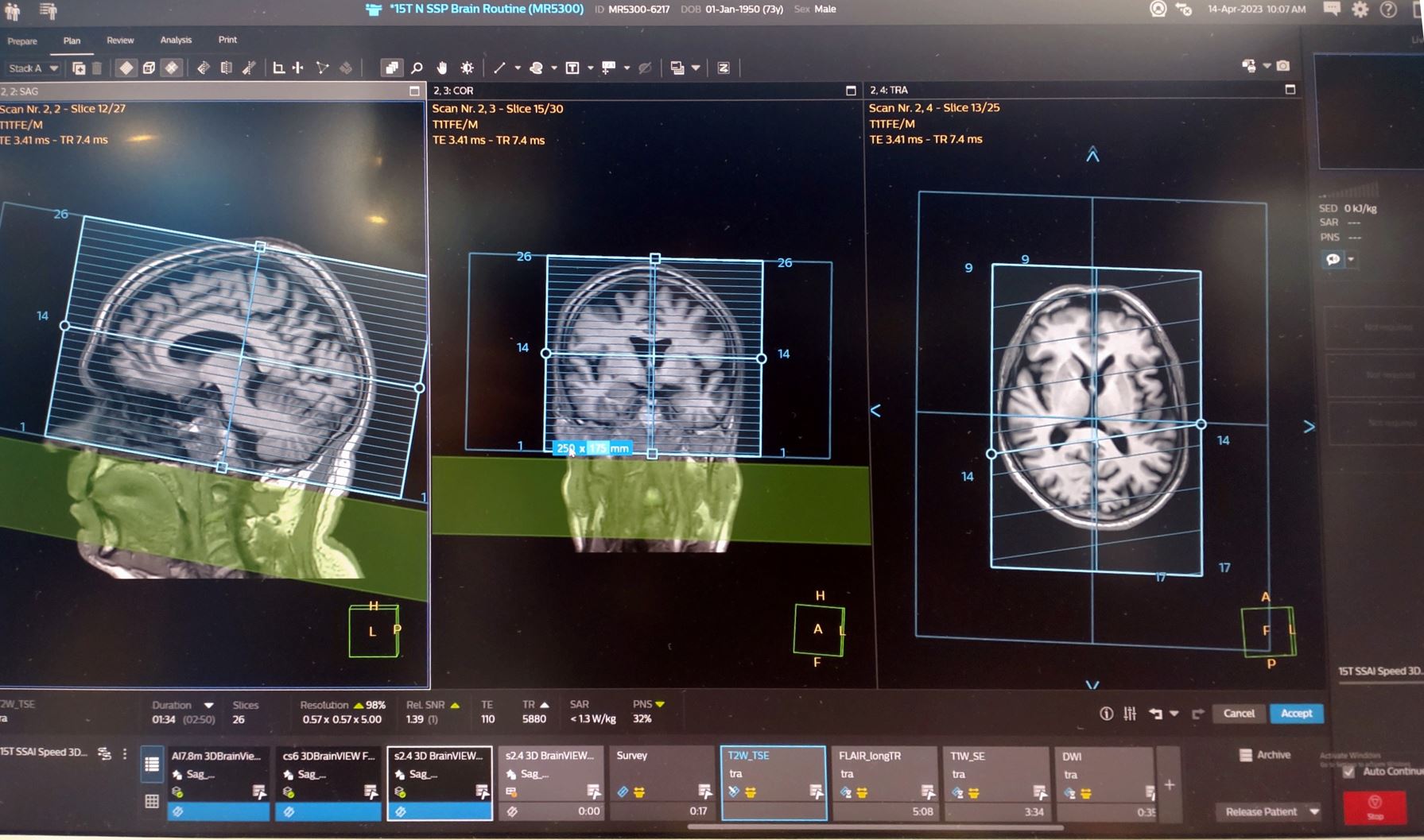 ITEM2023 ~Philips編~ | MRIfan.net