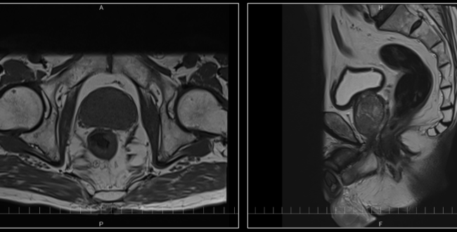 Fig.4-650x330.png