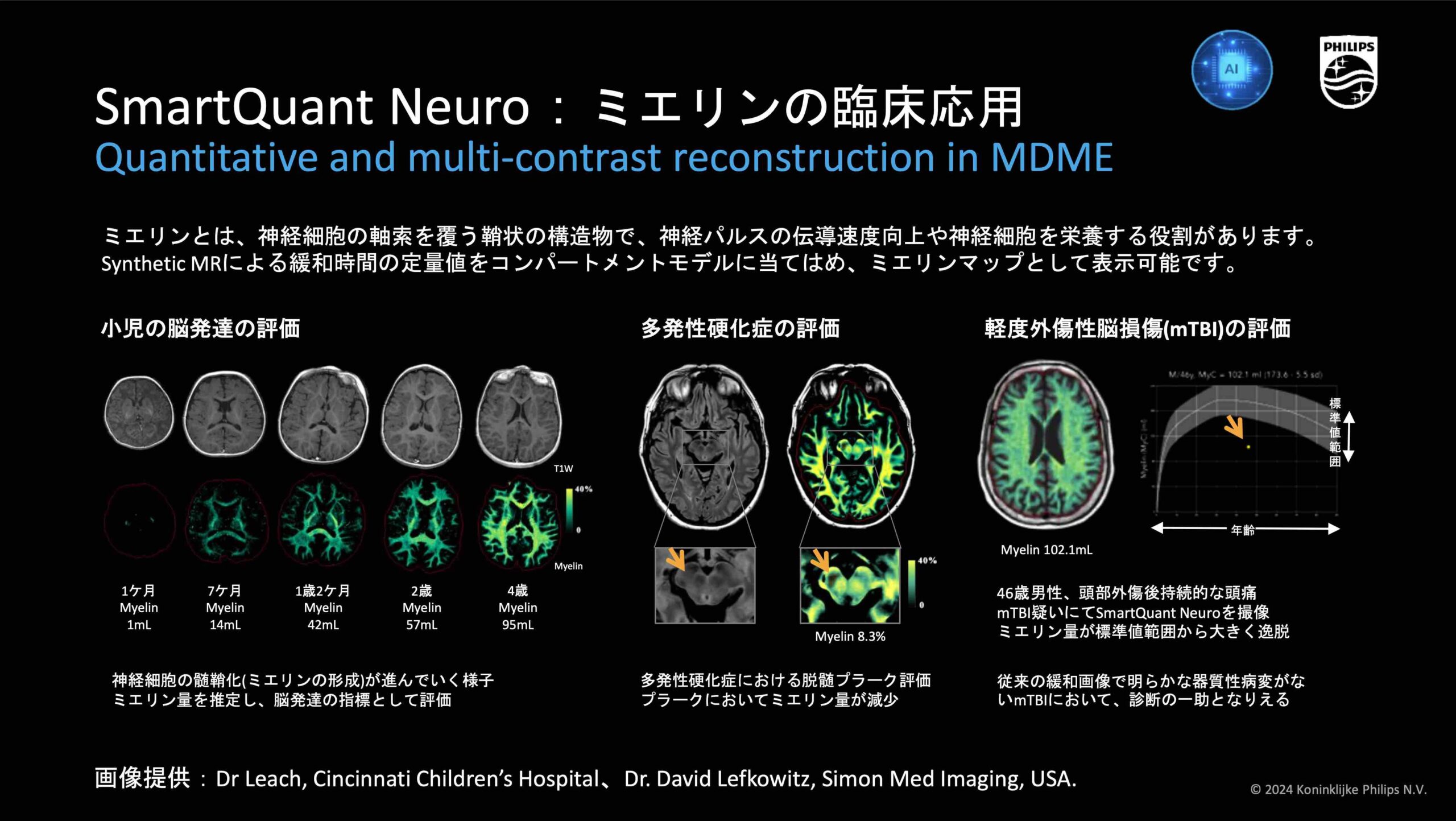 ITEM2024レポート〜Philips編〜 | MRIfan.net