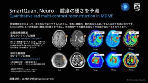 ITEM2024レポート〜Philips編〜 | MRIfan.net