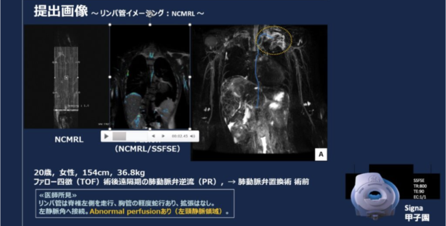新リンパ療法　モアレ画像診断一式 新リンパ療法 モアレ画像診断一式